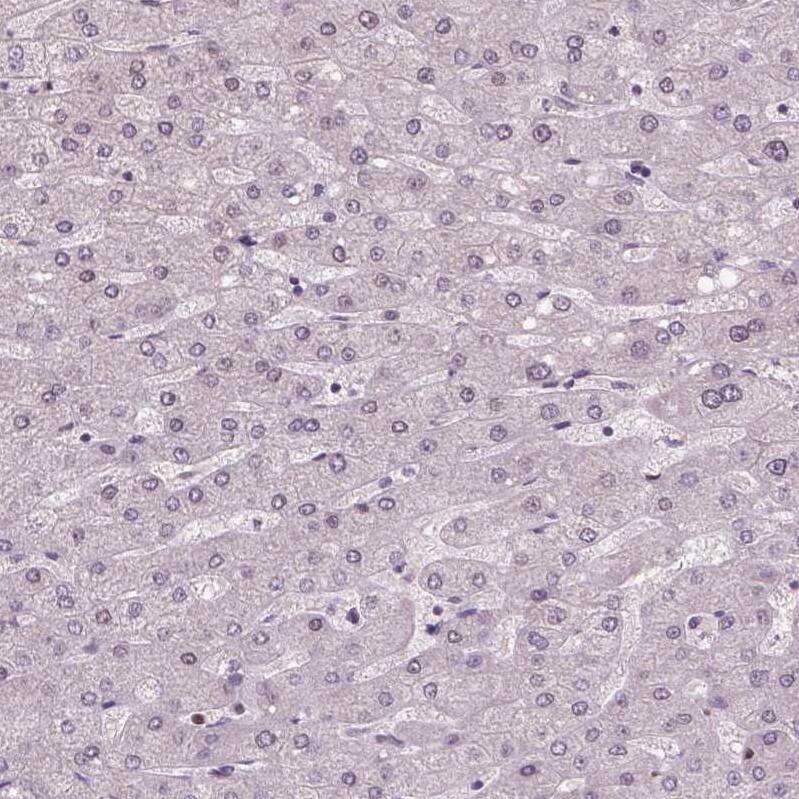 WHSC1 Antibody (CL1063) - Azide and BSA Free Immunohistochemistry-Paraffin: WHSC1 Antibody [NBP3-44042]