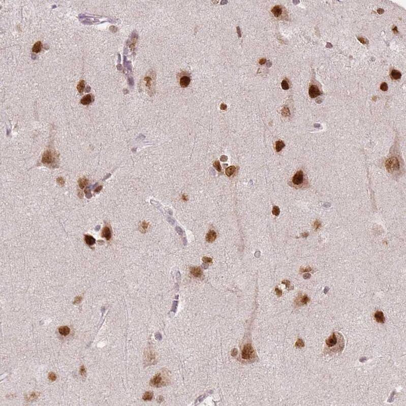 WHSC1 Antibody (CL1063) - Azide and BSA Free Immunohistochemistry-Paraffin: WHSC1 Antibody [NBP3-44042]