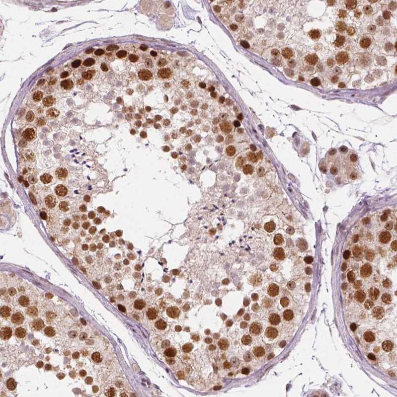 WHSC1 Antibody (CL1063) - Azide and BSA Free Immunohistochemistry-Paraffin: WHSC1 Antibody [NBP3-44042]