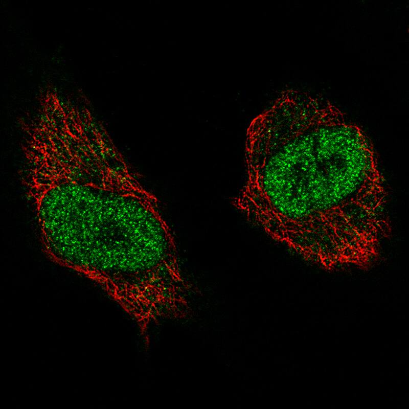 WHSC1 Antibody (CL1063) - Azide and BSA Free Immunocytochemistry/ Immunofluorescence: WHSC1 Antibody [NBP3-44042]