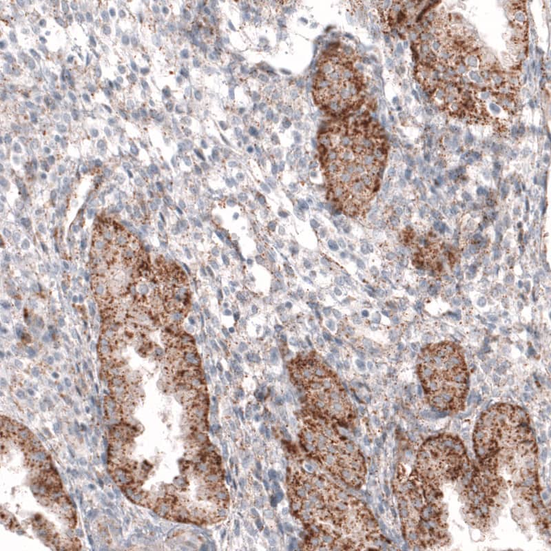 Granulin Antibody (CL5695) - Azide and BSA Free Immunohistochemistry-Paraffin: Granulin Antibody [NBP3-44044]