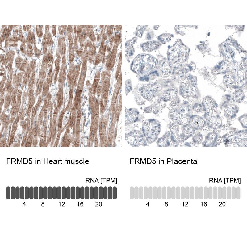 FRMD5 Antibody (CL9503) - Azide and BSA Free Immunohistochemistry-Paraffin: FRMD5 Antibody [NBP3-44045]