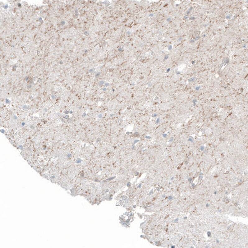 FRMD5 Antibody (CL9503) - Azide and BSA Free Immunohistochemistry-Paraffin: FRMD5 Antibody [NBP3-44045]