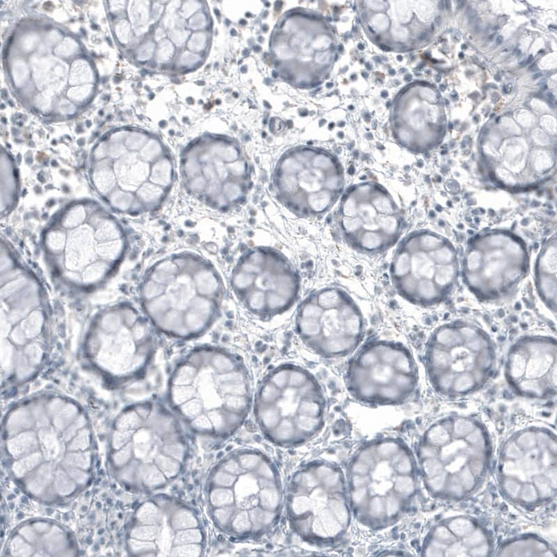 FRMD5 Antibody (CL9503) - Azide and BSA Free Immunohistochemistry-Paraffin: FRMD5 Antibody [NBP3-44045]