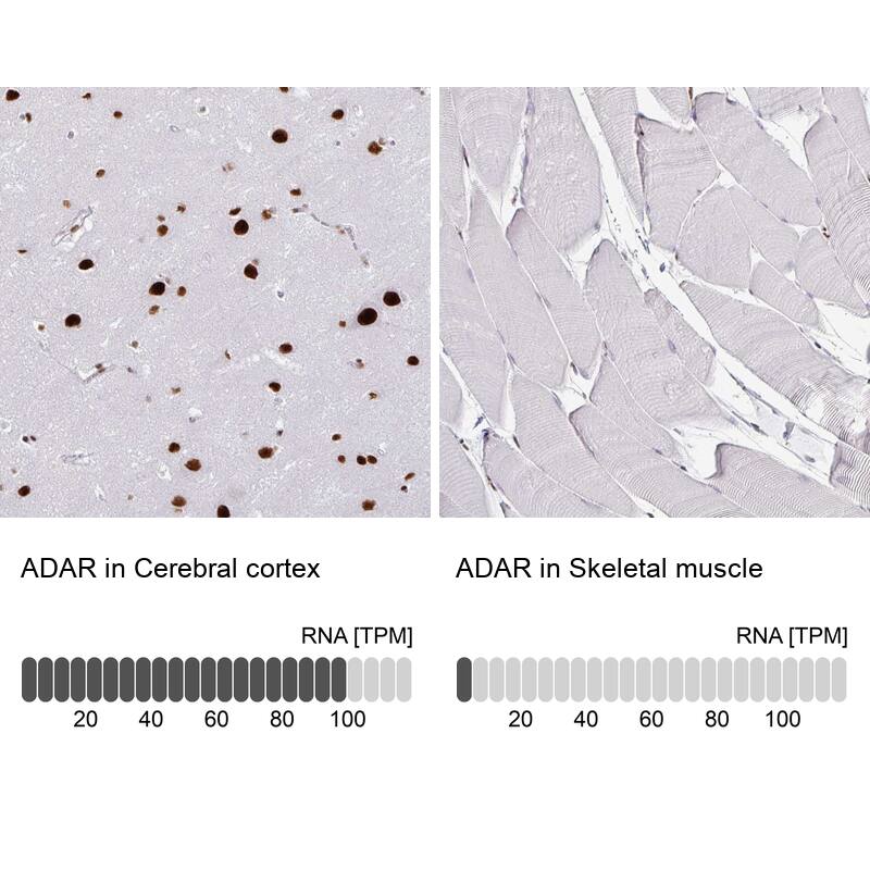 ADAR Antibody (CL0176) - Azide and BSA Free Immunohistochemistry-Paraffin: ADAR Antibody [NBP3-44046]