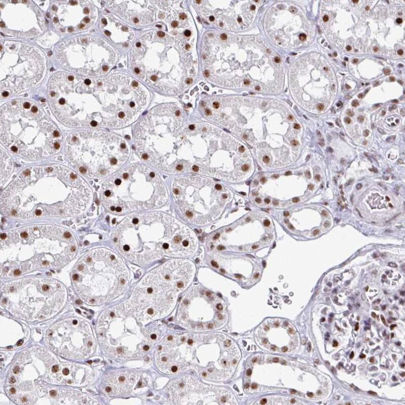 ADAR Antibody (CL0176) - Azide and BSA Free Immunohistochemistry-Paraffin: ADAR Antibody [NBP3-44046]