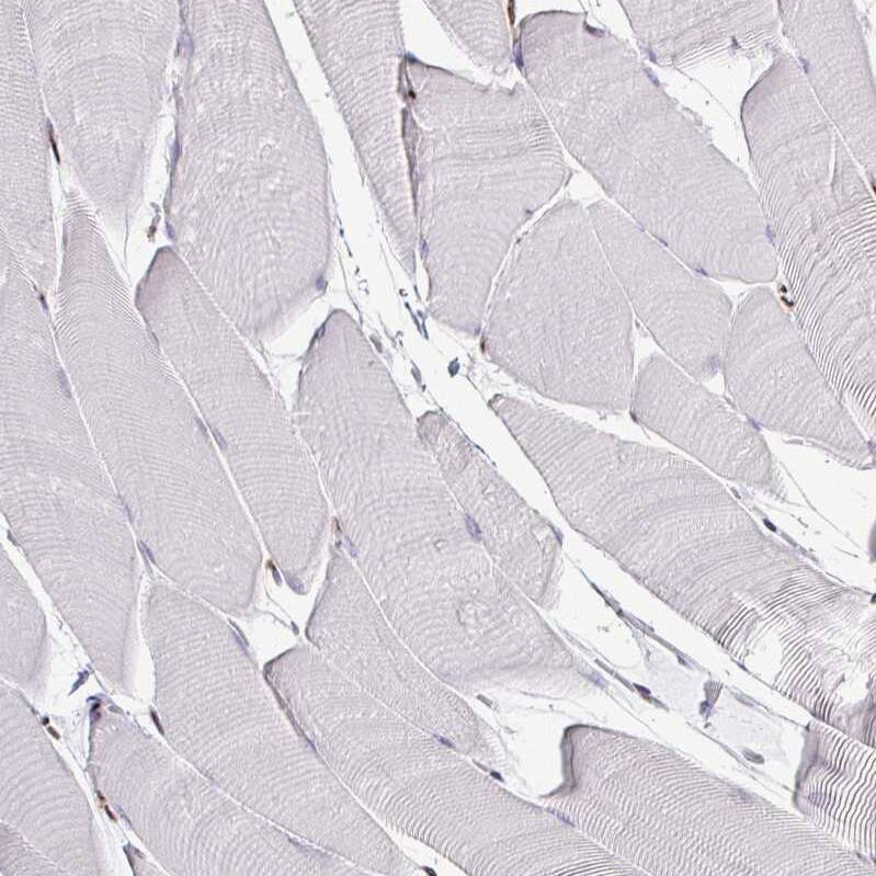 ADAR Antibody (CL0176) - Azide and BSA Free Immunohistochemistry-Paraffin: ADAR Antibody [NBP3-44046]