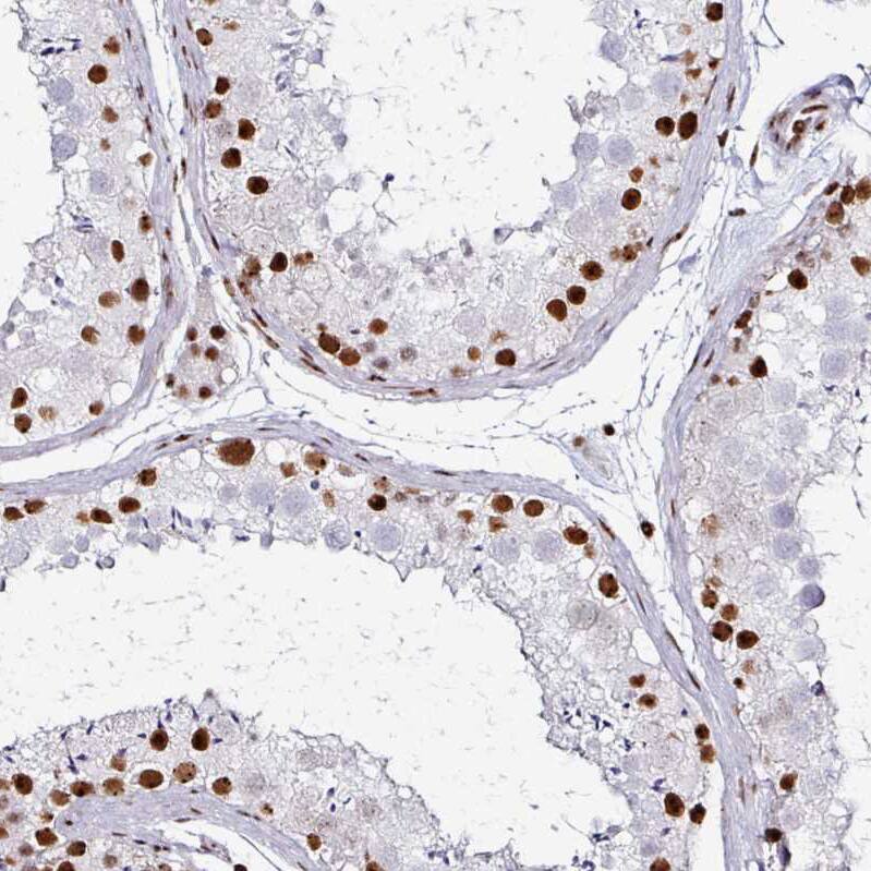 ADAR Antibody (CL0176) - Azide and BSA Free Immunohistochemistry-Paraffin: ADAR Antibody [NBP3-44046]
