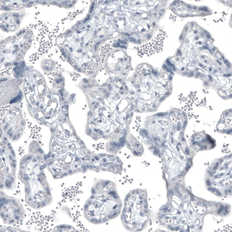 Kallikrein 3/PSA Antibody (CL9414) - Azide and BSA Free Immunohistochemistry-Paraffin: Kallikrein 3/PSA Antibody [NBP3-44047]