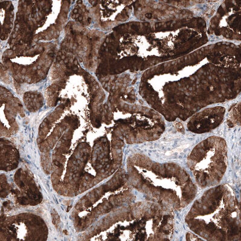 Kallikrein 3/PSA Antibody (CL9414) - Azide and BSA Free Immunohistochemistry-Paraffin: Kallikrein 3/PSA Antibody [NBP3-44047]