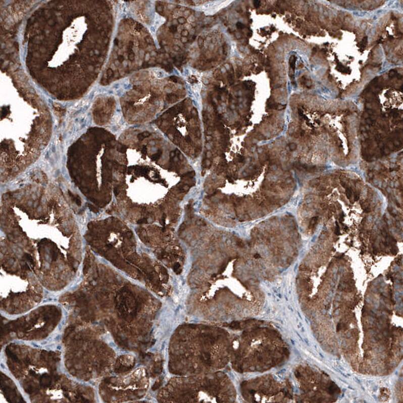 Kallikrein 3/PSA Antibody (CL9422) - Azide and BSA Free Immunohistochemistry-Paraffin: Kallikrein 3/PSA Antibody [NBP3-44048]