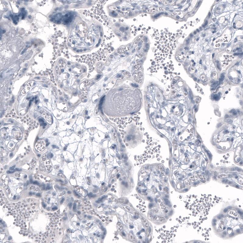 Kallikrein 3/PSA Antibody (CL9422) - Azide and BSA Free Immunohistochemistry-Paraffin: Kallikrein 3/PSA Antibody [NBP3-44048]