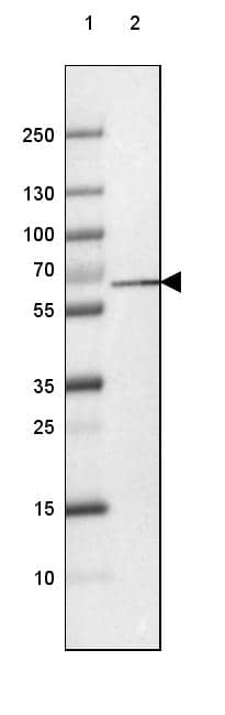 PGM1 Antibody (CL3299) - Azide and BSA Free Western Blot: PGM1 Antibody [NBP3-44049]