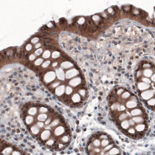 PGM1 Antibody (CL3299) - Azide and BSA Free Immunohistochemistry-Paraffin: PGM1 Antibody [NBP3-44049]