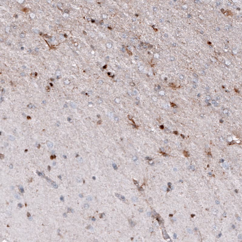 Osteopontin/OPN Antibody (CL10686) - Azide and BSA Free Immunohistochemistry-Paraffin: Osteopontin/OPN Antibody [NBP3-44052]