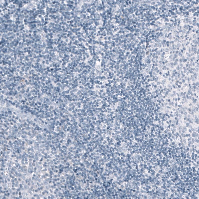 Osteopontin/OPN Antibody (CL10686) - Azide and BSA Free Immunohistochemistry-Paraffin: Osteopontin/OPN Antibody [NBP3-44052]