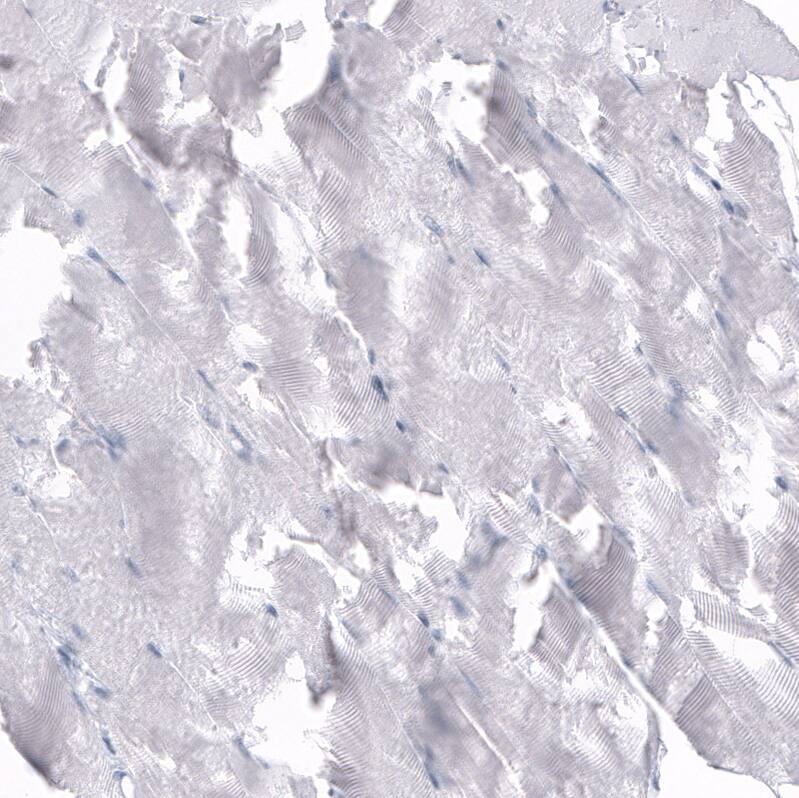 Osteopontin/OPN Antibody (CL10686) - Azide and BSA Free Immunohistochemistry-Paraffin: Osteopontin/OPN Antibody [NBP3-44052]