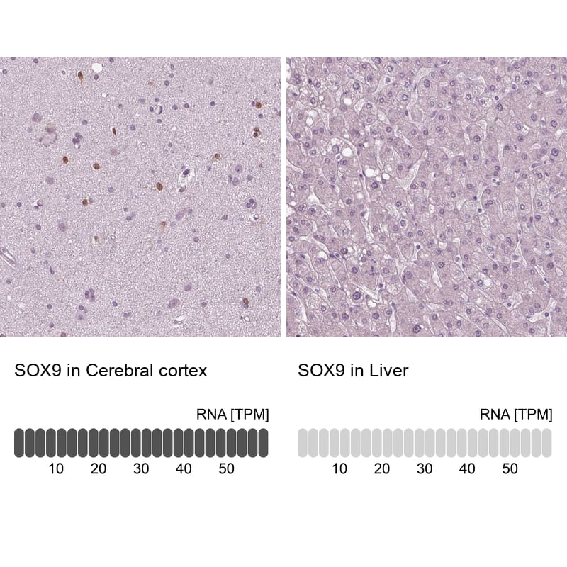 SOX9 Antibody (CL0639) - Azide and BSA Free Immunohistochemistry-Paraffin: SOX9 Antibody [NBP3-44053]