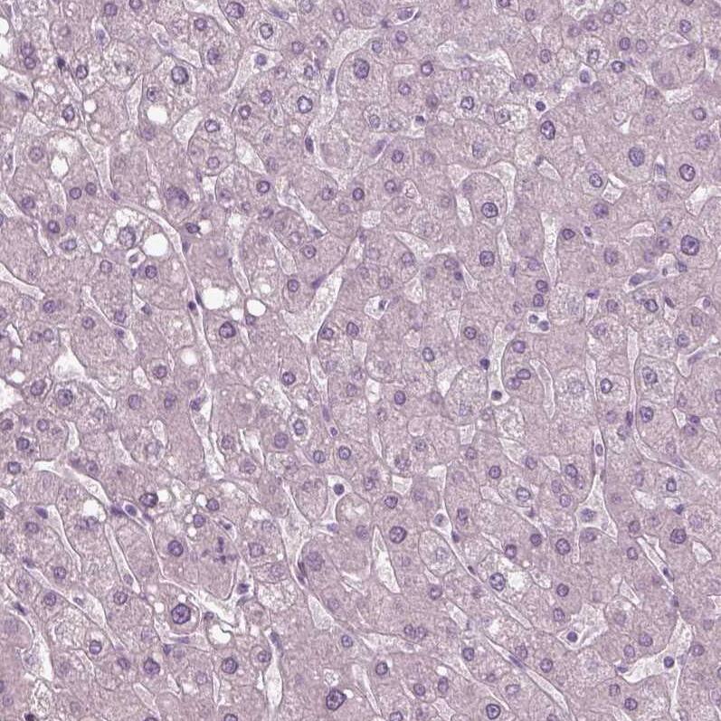 SOX9 Antibody (CL0639) - Azide and BSA Free Immunohistochemistry-Paraffin: SOX9 Antibody [NBP3-44053]