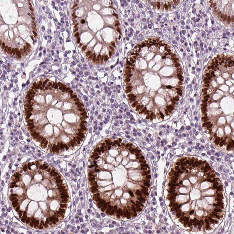 SOX9 Antibody (CL0639) - Azide and BSA Free Immunohistochemistry-Paraffin: SOX9 Antibody [NBP3-44053]