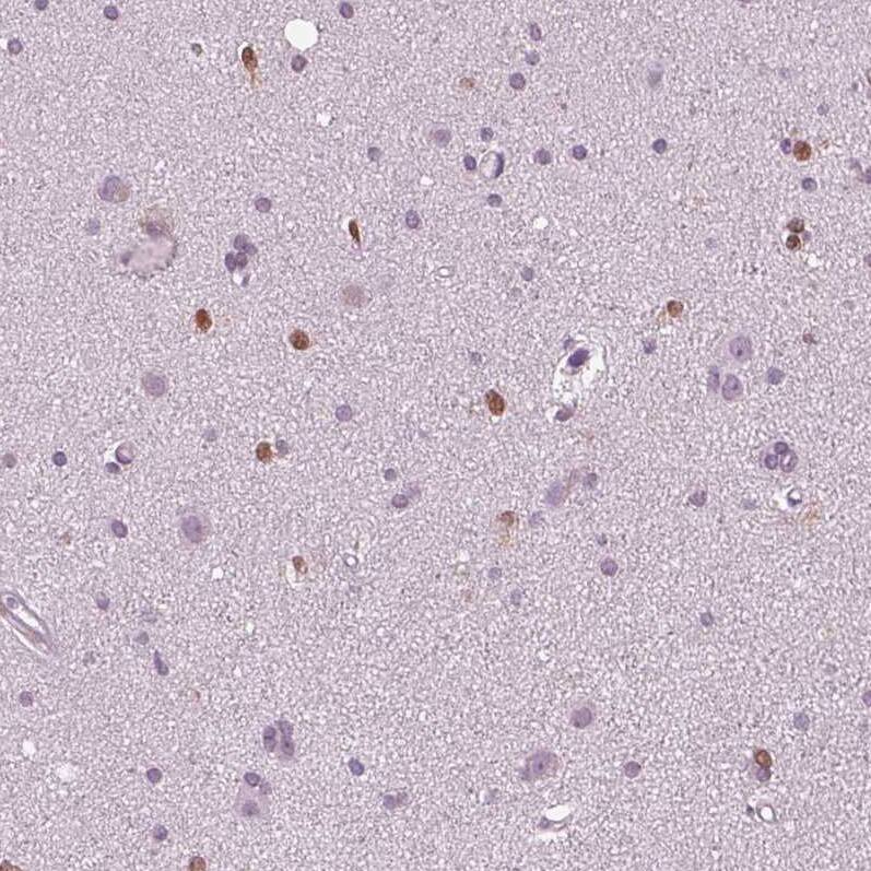 SOX9 Antibody (CL0639) - Azide and BSA Free Immunohistochemistry-Paraffin: SOX9 Antibody [NBP3-44053]