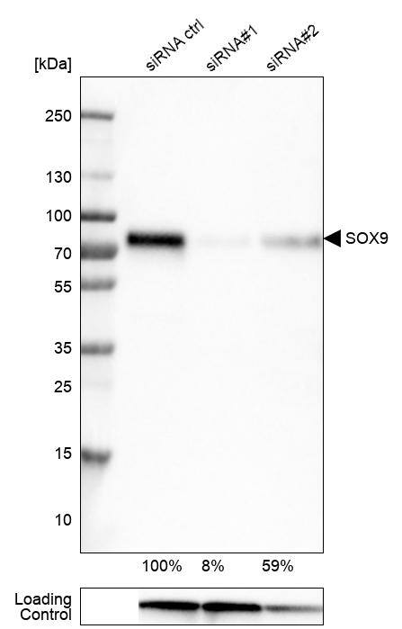 SOX9 Antibody (CL0639) - Azide and BSA Free Western Blot: SOX9 Antibody [NBP3-44053]
