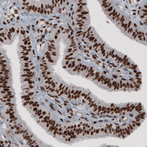 hnRNP C1 + C2 Antibody (CL2593) - Azide and BSA Free Immunohistochemistry-Paraffin: hnRNP C1 + C2 Antibody [NBP3-44054]