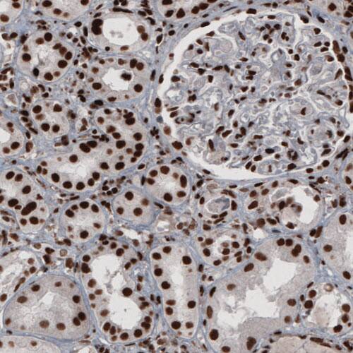 hnRNP C1 + C2 Antibody (CL2593) - Azide and BSA Free Immunohistochemistry-Paraffin: hnRNP C1 + C2 Antibody [NBP3-44054]