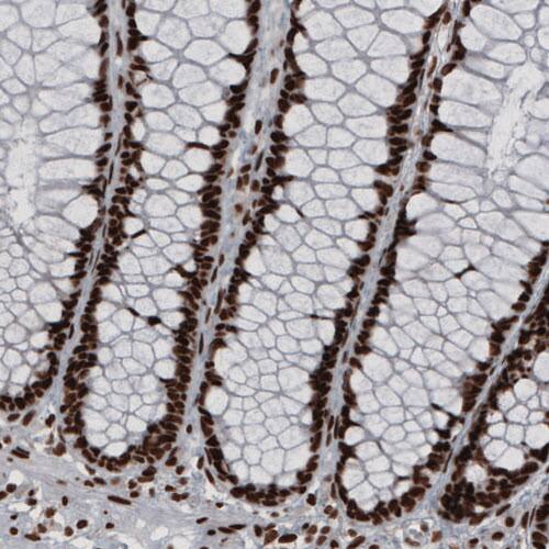 hnRNP C1 + C2 Antibody (CL2593) - Azide and BSA Free Immunohistochemistry-Paraffin: hnRNP C1 + C2 Antibody [NBP3-44054]