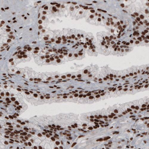 hnRNP C1 + C2 Antibody (CL2593) - Azide and BSA Free Immunohistochemistry-Paraffin: hnRNP C1 + C2 Antibody [NBP3-44054]