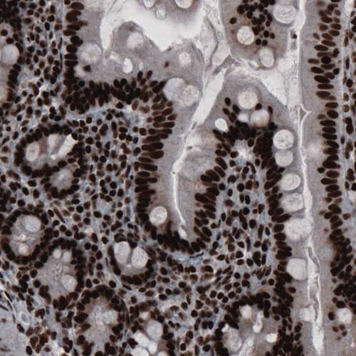 hnRNP C1 + C2 Antibody (CL2593) - Azide and BSA Free Immunohistochemistry-Paraffin: hnRNP C1 + C2 Antibody [NBP3-44054]
