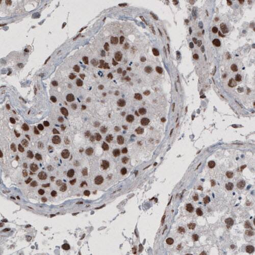 hnRNP C1 + C2 Antibody (CL2593) - Azide and BSA Free Immunohistochemistry-Paraffin: hnRNP C1 + C2 Antibody [NBP3-44054]