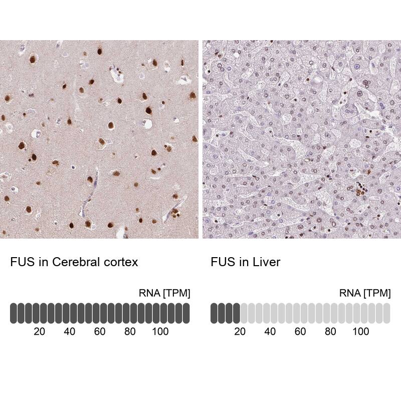 FUS Antibody (CL0190) - Azide and BSA Free Immunohistochemistry-Paraffin: FUS Antibody [NBP3-44055]