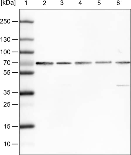 FUS Antibody (CL0190) - Azide and BSA Free Western Blot: FUS Antibody [NBP3-44055]