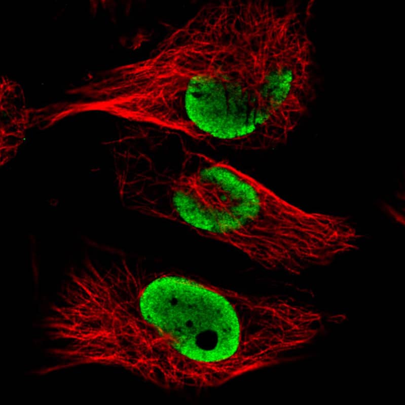 FUS Antibody (CL0190) - Azide and BSA Free Immunocytochemistry/ Immunofluorescence: FUS Antibody [NBP3-44055]