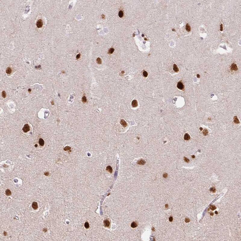 FUS Antibody (CL0190) - Azide and BSA Free Immunohistochemistry-Paraffin: FUS Antibody [NBP3-44055]