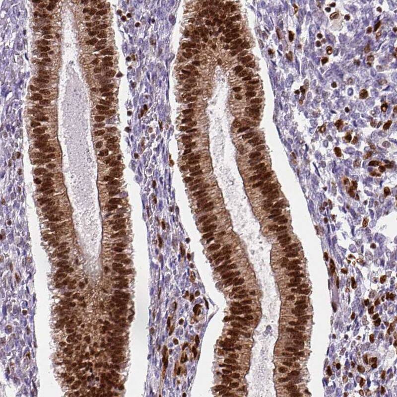 FUS Antibody (CL0190) - Azide and BSA Free Immunohistochemistry-Paraffin: FUS Antibody [NBP3-44055]