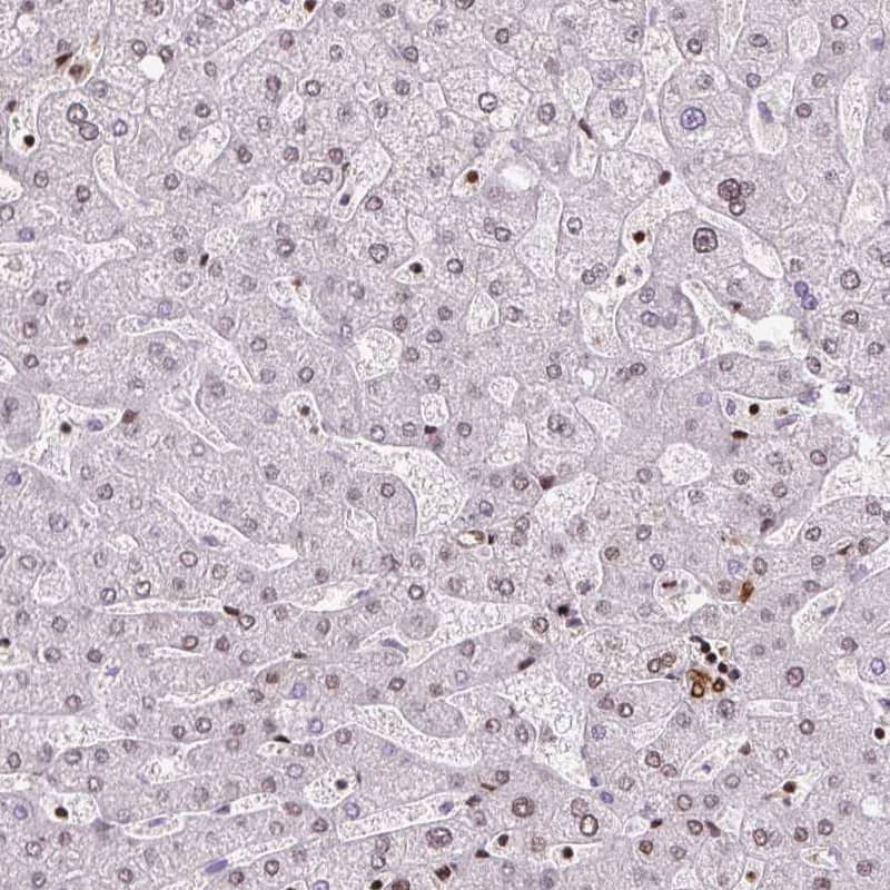 FUS Antibody (CL0190) - Azide and BSA Free Immunohistochemistry-Paraffin: FUS Antibody [NBP3-44055]