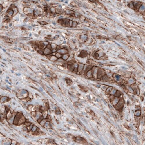 beta-Catenin Antibody (CL3689) - Azide and BSA Free Immunohistochemistry-Paraffin: beta-Catenin Antibody [NBP3-44056]