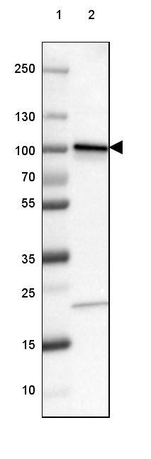 beta-Catenin Antibody (CL3689) - Azide and BSA Free Western Blot: beta-Catenin Antibody [NBP3-44056]