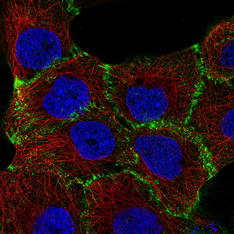 beta-Catenin Antibody (CL3689) - Azide and BSA Free Immunocytochemistry/ Immunofluorescence: beta-Catenin Antibody [NBP3-44056]