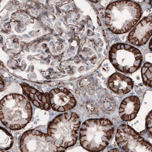 beta-Catenin Antibody (CL3689) - Azide and BSA Free Immunohistochemistry-Paraffin: beta-Catenin Antibody [NBP3-44056]