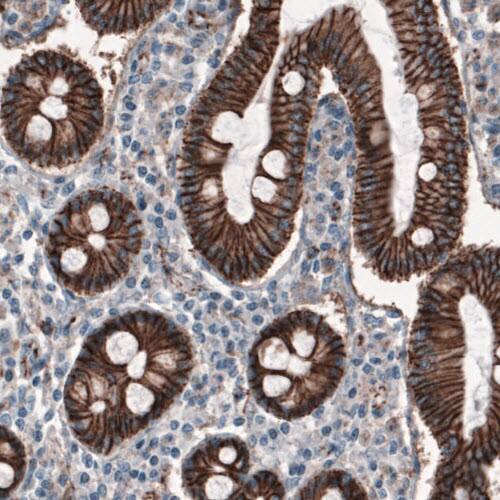 beta-Catenin Antibody (CL3689) - Azide and BSA Free Immunohistochemistry-Paraffin: beta-Catenin Antibody [NBP3-44056]
