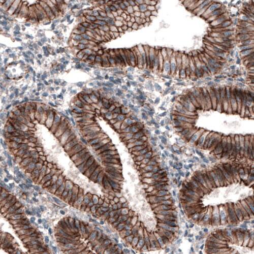 beta-Catenin Antibody (CL3689) - Azide and BSA Free Immunohistochemistry-Paraffin: beta-Catenin Antibody [NBP3-44056]