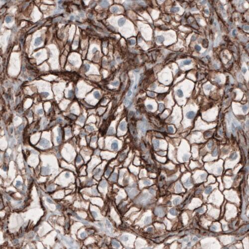 beta-Catenin Antibody (CL3689) - Azide and BSA Free Immunohistochemistry-Paraffin: beta-Catenin Antibody [NBP3-44056]
