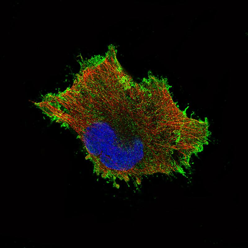 beta-Catenin Antibody (CL3689) - Azide and BSA Free Immunocytochemistry/ Immunofluorescence: beta-Catenin Antibody [NBP3-44056]