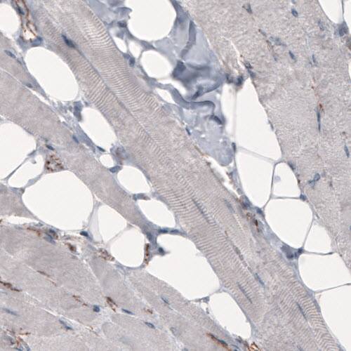 beta-Catenin Antibody (CL3689) - Azide and BSA Free Immunohistochemistry-Paraffin: beta-Catenin Antibody [NBP3-44056]