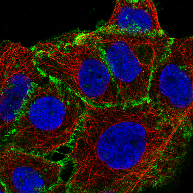 beta-Catenin Antibody (CL3691) - Azide and BSA Free Immunocytochemistry/ Immunofluorescence: beta-Catenin Antibody [NBP3-44057]