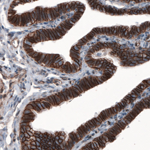 beta-Catenin Antibody (CL3691) - Azide and BSA Free Immunohistochemistry-Paraffin: beta-Catenin Antibody [NBP3-44057]