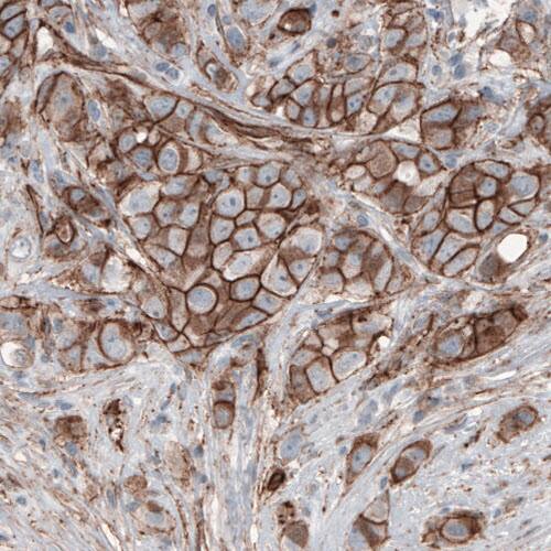 beta-Catenin Antibody (CL3691) - Azide and BSA Free Immunohistochemistry-Paraffin: beta-Catenin Antibody [NBP3-44057]